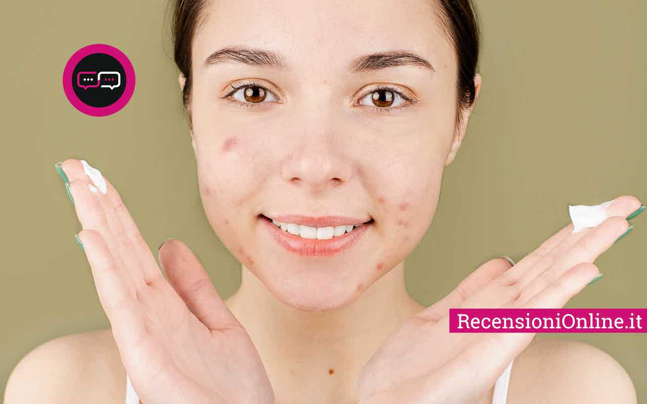 come eliminare acne RecensioniOnline.it